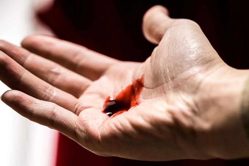 Krwawe wymioty u psów