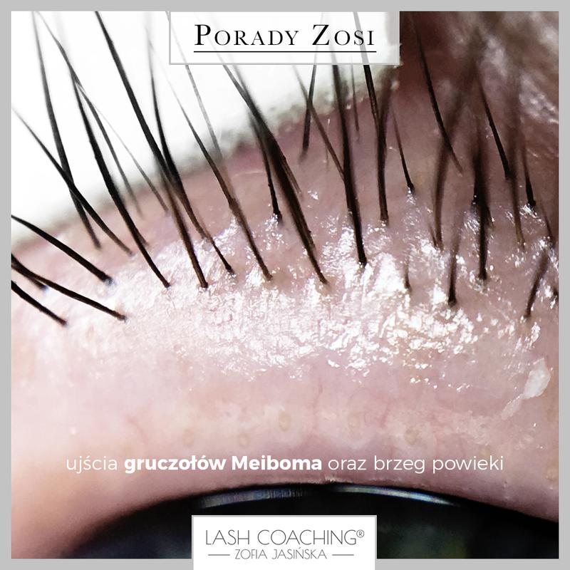 Naturalne metody na gruczoły okołoodbytowe