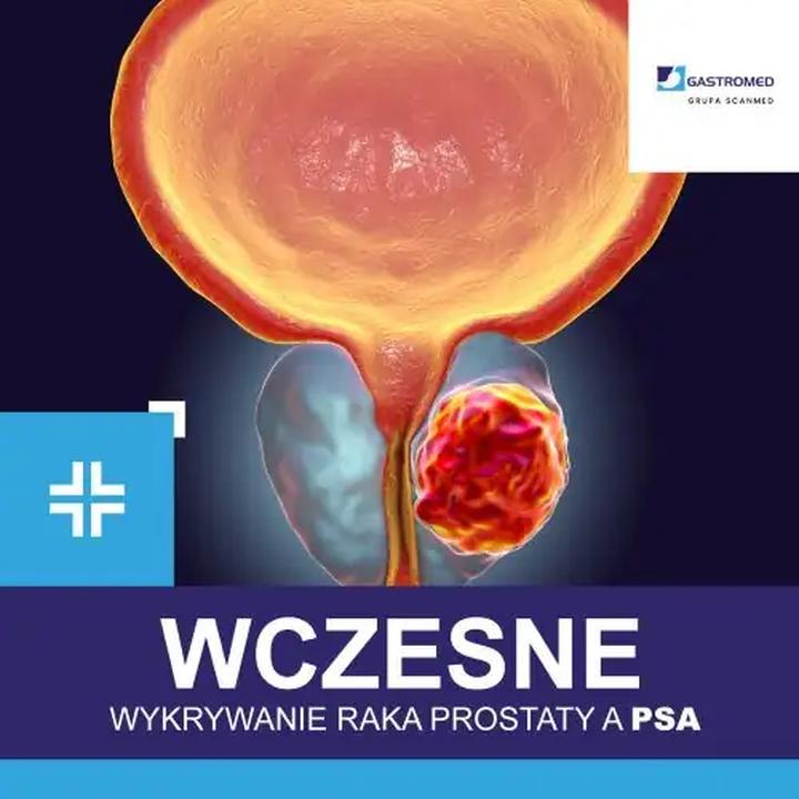 Czy wysokie psa zawsze oznacza raka? 5 rzeczy, które warto wiedzieć