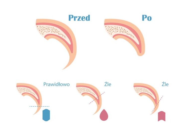 Jak prawidłowo obciąć paznokcie psu, aby zadbać o jego zdrowie i komfort?